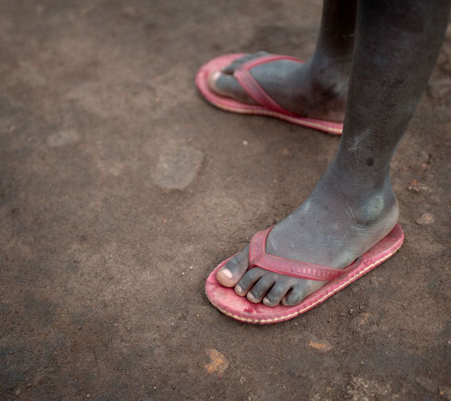 Støvete føtter med rosa sandaler står på en leirete, tørr bakke. Bildet blir brukt som en illustrasjon i artikkel Ny voldsbølge rammer Kongo. Foto SOS-barnebyer